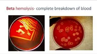 Hemolysis video mp4