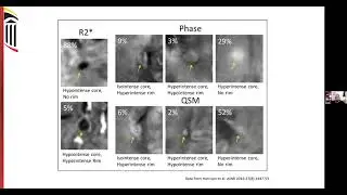 Insights into multiple sclerosis pathology from 7T MRI -- Dr. Daniel Harrison, M.D