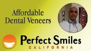 Chula Vista CA Affordable Dental Veneers| Cosmetic Chula Vista CA Dentist|Dr. David Garate