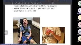 MRCPCH (CP) Clinical Exam Revision Series 16