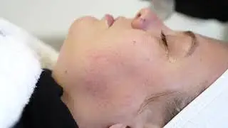 The Sweet Lift Treatment