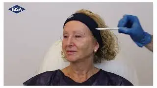 Aliaxin: T&eacute;cnicas y abordajes full face