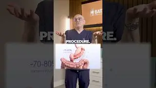 Endoscopic Sleeve or Ozempic Better For Weight Loss