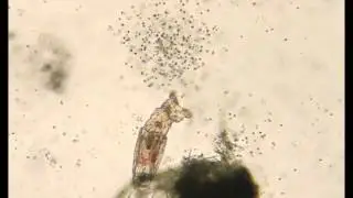 Rotifer feeding