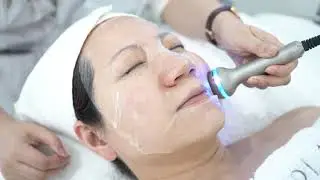 Who is suitable for LDM treatment? - Glow Perla in Chatswood Sydney