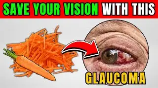 These 6 FOODS can SAVE Your Eyes from GLAUCOMA!