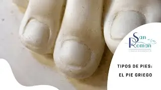 Tipos de pies: El Pie Griego 👣 Cl&iacute;nica San Rom&aacute;n