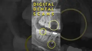 Digital Dental Scans: What They Tell Us About Your Smile