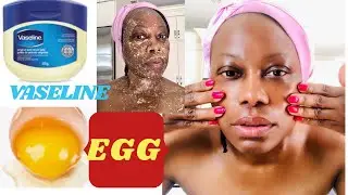 EGG & VASELINE WILL TRANSFORM YOUR SKIN INSTANTLY TO REDUCE SIGNS OF AGING #glassskin #eggmask
