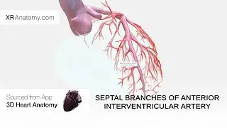 Septal branches of anterior interventricular artery