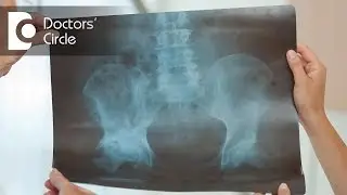 How is Arthritis diagnosed? - Dr. Yogesh Singh