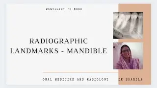 RADIOGRAPHICAL LANDMARKS -MANDIBLE(Kindly use🎧)