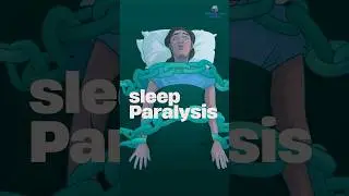 What is Sleep Paralysis and how to recognize it? | Sleep Paralysis in Hindi | Dr. Kunal Bahrani