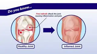 BIOBAY Joingard | Get rid of the joint pain phobia