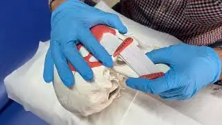Discover the art of distraction technique in pain management with this insightful video