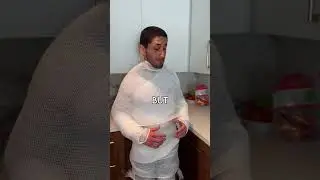 Я СЛОМАЛ РУКУ...