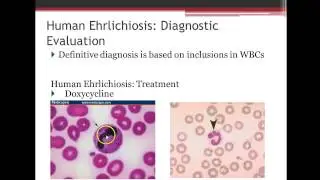 Immunology: Tick-borne Diseases