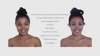 Carboxytherapy