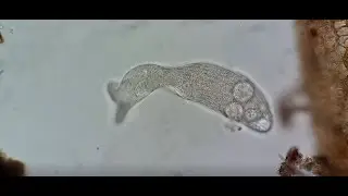 Spathidium sp.
