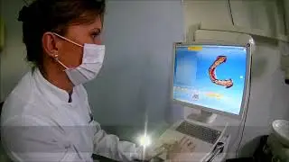 Scanner Intraoral - Digital Face Radiologia