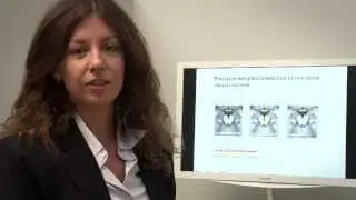 Hierarchical Prediction Errors in Sensory Learning