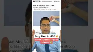 Fatty Liver in Kids - Do Not Ignore ❌ Harvard Trained Doctor Explains #health #healthtips