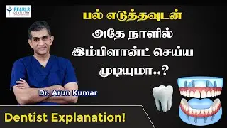Can Dental Implants Be Placed Immediately After Extraction..? | Dr. Arun Kumar | Chennai