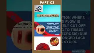 Medteach Explains Ischemia in Detail | Complete Medical Guide_Part_02