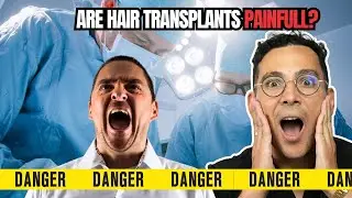 Are Hair Transplants Painful? Doctor Explains the Truth