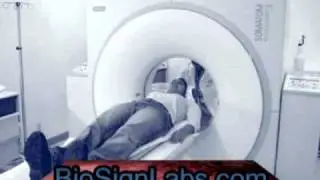 BioSign Labs testing for Mold in the Human body, Mold Sickness and mold related Illness