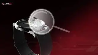 Penteq Technologie f&uuml;r &micro;Data Matrix Codes | Innovation in der Lasertechnik