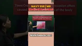 Navy SSR/MR  Medical Assistant Medical Test Shocking Fact! #shorts #shortsfeed