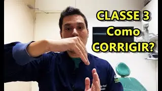 Classe 3 em ortodontia - como corrigir?