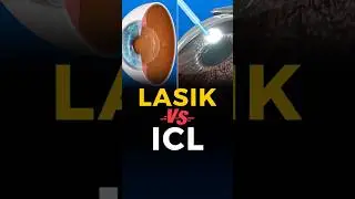 ICL vs Lasik Surgery