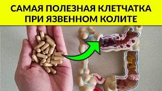 Мировая Практика: Какая КЛЕТЧАТКА Помогает при ЯЗВЕННОМ КОЛИТЕ?
