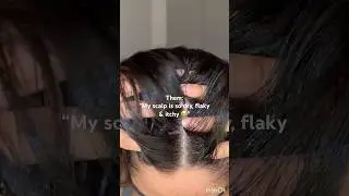 This might be one of the reasons your scalp is so itchy & dry ☝🏼🤯 #hair #haircare #shorts #scalp