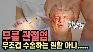 무릎 관절염 or 퇴행성 관절염, 무릎통증 서서히 진행되는 병! 빠른 대처로 발병시기를 늦춰요 l 에스앤케이병원 문경호 원장