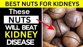 5 Super Nuts to Protect Your Kidneys ( 2 to Avoid)