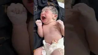 First Cry in NICU! Newborn&rsquo;s Journey from Delivery Room to Observation 👶💙 #prematurityday #nicu
