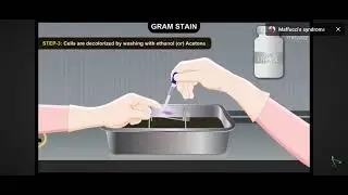 #staining process#and difference between gram positive and gram negative bacteria #like#share