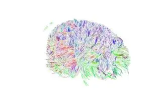 Exploration of the Brain's White Matter Structure through Multi-Scale Local Contraction