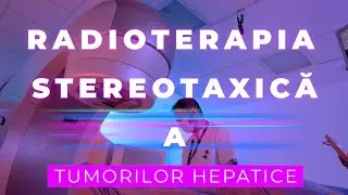 RADIOTERAPIA STEREOTAXICĂ A TUMORILOR HEPATICE #radioterapia #tumori #cancerhepatic
