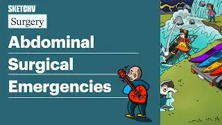 Abdominal Surgical Emergencies (Internal Medicine) | Sketchy Medical