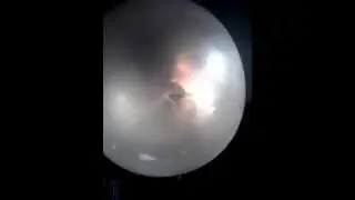 How to blow a chewing gum bubble like a pro