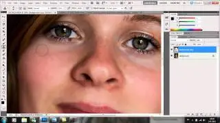 photoshop cs5 - removing pimples, spots etc.