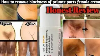 Which cream is best for skin whitening | Does CosIQ work #trending #viralvideo