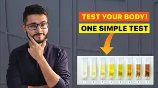1 SIMPLE TEST to check your BODY ✅  (hydration levels) #shorts