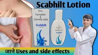Permethrin 5% lotion ✅️ || scabies treatment || Head lice treatment 📈#scabies​ #skinItching #khujli