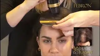 FEBRON Hair Fibers For Thinning Hair DARK BROWN Giant 30G For Women | RestOviebelle