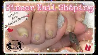 Pedicure Tutorial How to Cut and Shape Pincer Toenails at Home